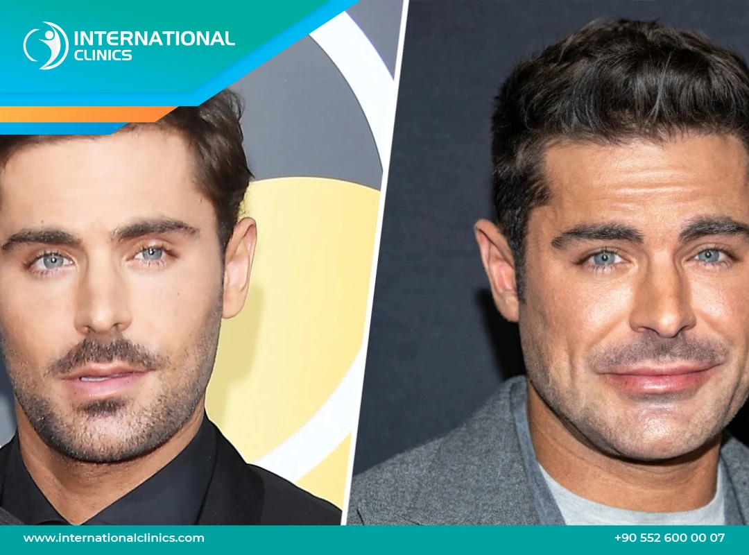 Zac Efron What to Expect in 2025 Invisiverse News(02)